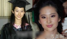 明星爆料整容视频大全下载,视频大全下载解析